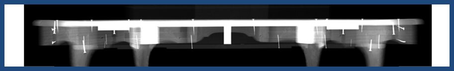 Image5a_bottom body TAC front section.png