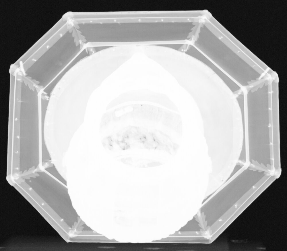 Fossano, Cattedrale, S. Dorerio, Reliquiario di San Giovenale - radiografia digitale
