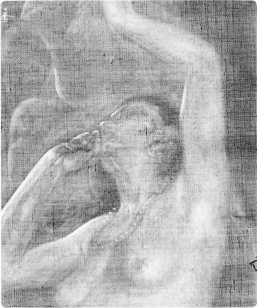 Moncalieri, Castello, F. Romero, Aspasia, inv. 5196 - radiografia digitale RX